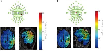 Anodal tDCS Over the Right Temporoparietal Junction Lowers Overbidding in Contests